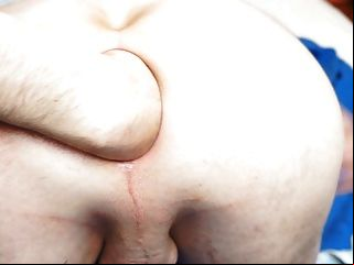 anal gape gaping asshole anal webcam porn tube video 1